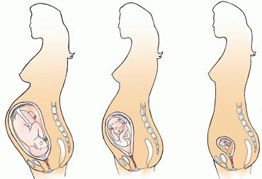 stupňov vývoja tehotenstva