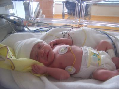 Pneumónia u novorodenca: ohromné ​​a nebezpečné ochorenie
